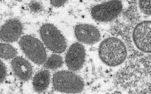 世卫组织今宣猴痘为国际公共卫生紧急事件